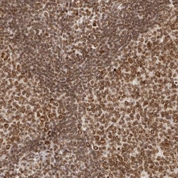 Invitrogen NUP153 Polyclonal Antibody 100 &mu;L; Unconjugated:Antibodies,