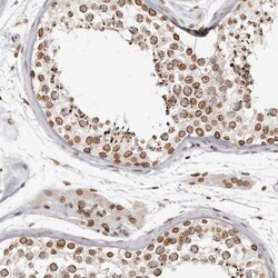 Invitrogen NUP153 Polyclonal Antibody 100 &mu;L; Unconjugated:Antibodies,