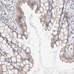 Invitrogen DOPEY1 Polyclonal Antibody 100 &mu;L; Unconjugated:Antibodies,