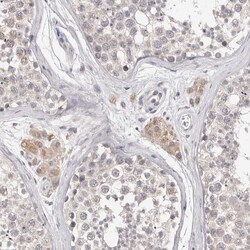 Invitrogen DOPEY1 Polyclonal Antibody 100 &mu;L; Unconjugated:Antibodies,