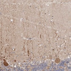 Invitrogen DOPEY1 Polyclonal Antibody 100 &mu;L; Unconjugated:Antibodies,