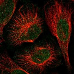 Invitrogen DOPEY1 Polyclonal Antibody 100 &mu;L; Unconjugated:Antibodies,