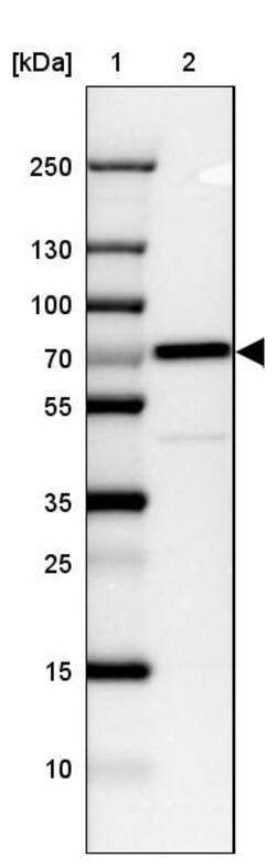 Invitrogen CTNNBL1 Polyclonal Antibody 100 &mu;L; Unconjugated:Antibodies,