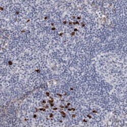 Invitrogen TBC1D22B Polyclonal Antibody 100 &mu;L; Unconjugated:Antibodies,