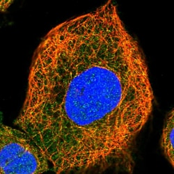 Invitrogen AIDA Polyclonal Antibody 100 &mu;L; Unconjugated:Antibodies,
