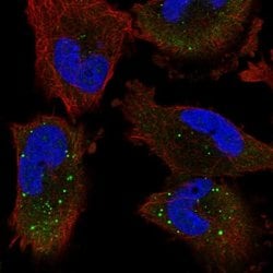Invitrogen UNK Polyclonal Antibody 100 &mu;L; Unconjugated:Antibodies,