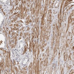 Invitrogen UNK Polyclonal Antibody 100 &mu;L; Unconjugated:Antibodies,