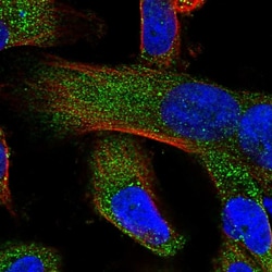 Invitrogen ZCCHC11 Polyclonal Antibody 100 &mu;L; Unconjugated:Antibodies,