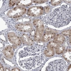 Invitrogen RTCA Polyclonal Antibody 100 &mu;L; Unconjugated:Antibodies,