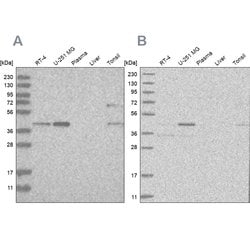 Invitrogen RTCA Polyclonal Antibody 100 &mu;L; Unconjugated:Antibodies,
