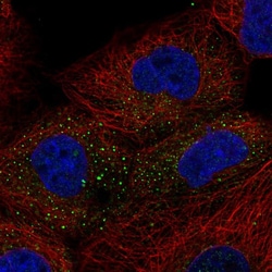 Invitrogen TIPRL Polyclonal Antibody 100 &mu;L; Unconjugated:Antibodies,