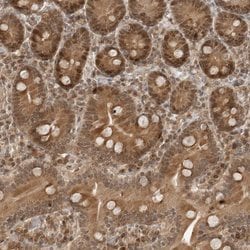 Invitrogen TIPRL Polyclonal Antibody 100 &mu;L; Unconjugated:Antibodies,