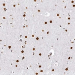 Invitrogen DHX9 Polyclonal Antibody 100 &mu;L; Unconjugated:Antibodies,