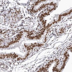 Invitrogen DHX9 Polyclonal Antibody 100 &mu;L; Unconjugated:Antibodies,
