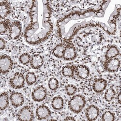Invitrogen DHX9 Polyclonal Antibody 100 &mu;L; Unconjugated:Antibodies,