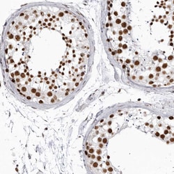 Invitrogen DHX9 Polyclonal Antibody 100 &mu;L; Unconjugated:Antibodies,