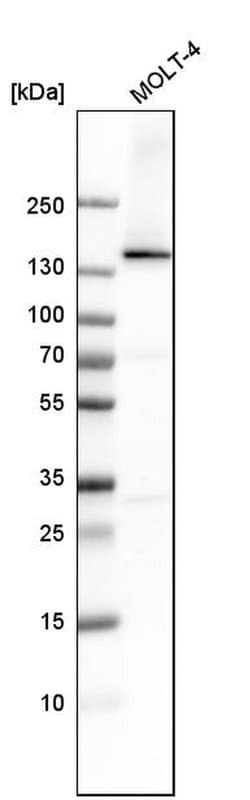 Invitrogen DHX9 Polyclonal Antibody 100 &mu;L; Unconjugated:Antibodies,
