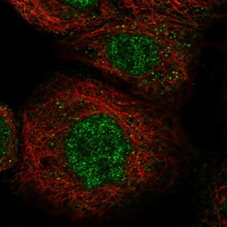 Invitrogen LYSMD1 Polyclonal Antibody 100 &mu;L; Unconjugated:Antibodies,