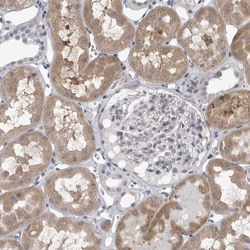Invitrogen LYSMD1 Polyclonal Antibody 100 &mu;L; Unconjugated:Antibodies,