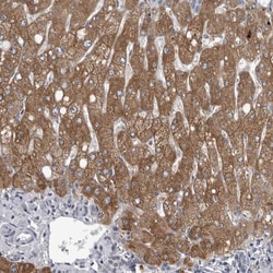 Invitrogen LYSMD1 Polyclonal Antibody 100 &mu;L; Unconjugated:Antibodies,
