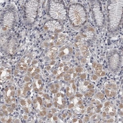 Invitrogen LYSMD1 Polyclonal Antibody 100 &mu;L; Unconjugated:Antibodies,