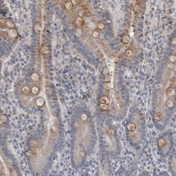 Invitrogen LYSMD1 Polyclonal Antibody 100 &mu;L; Unconjugated:Antibodies,