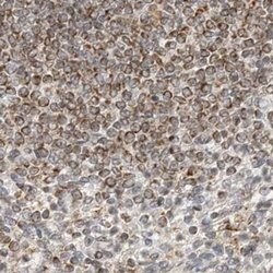 Invitrogen DYRK4 Polyclonal Antibody 100 &mu;L | Buy Online | Invitrogen&trade; | Fisher Scientific