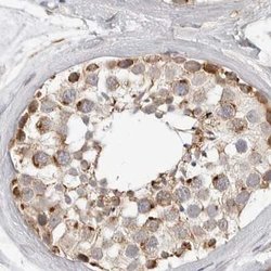 Invitrogen DYRK4 Polyclonal Antibody 100 &mu;L | Buy Online | Invitrogen&trade; | Fisher Scientific