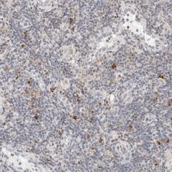 Invitrogen PARP10 Polyclonal Antibody 100 &mu;L; Unconjugated:Antibodies,