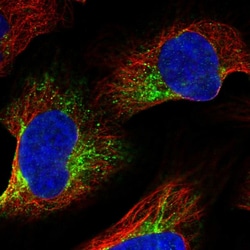 Invitrogen ZYG11B Polyclonal Antibody 100 &mu;L; Unconjugated:Antibodies,