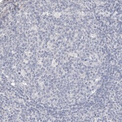Invitrogen ZYG11B Polyclonal Antibody 100 &mu;L; Unconjugated:Antibodies,