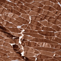 Invitrogen ZYG11B Polyclonal Antibody 100 &mu;L; Unconjugated:Antibodies,