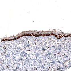 Invitrogen ZYG11B Polyclonal Antibody 100 &mu;L; Unconjugated:Antibodies,