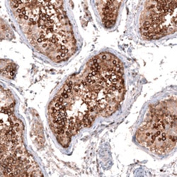 Invitrogen ZYG11B Polyclonal Antibody 100 &mu;L; Unconjugated:Antibodies,