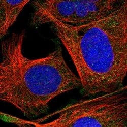 Invitrogen SNAP47 Polyclonal Antibody 100 &mu;L; Unconjugated:Antibodies,