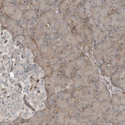 Invitrogen SNAP47 Polyclonal Antibody 100 &mu;L; Unconjugated:Antibodies,