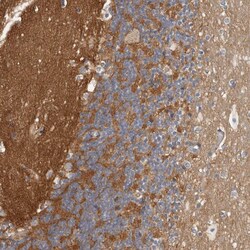 Invitrogen WDTC1 Polyclonal Antibody 100 &mu;L; Unconjugated:Antibodies,