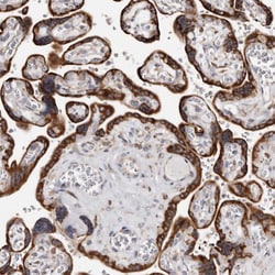 Invitrogen ACBD6 Polyclonal Antibody 100 &mu;L; Unconjugated:Antibodies,