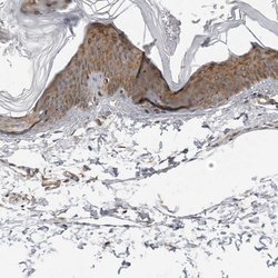 Invitrogen SRGAP2 Polyclonal Antibody 100 &mu;L; Unconjugated:Antibodies,