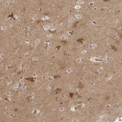 Invitrogen SRGAP2 Polyclonal Antibody 100 &mu;L; Unconjugated:Antibodies,