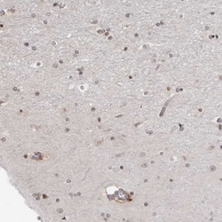 Invitrogen SRGAP2 Polyclonal Antibody 100 &mu;L; Unconjugated:Antibodies,