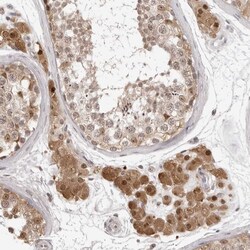 Invitrogen SRGAP2 Polyclonal Antibody 100 &mu;L; Unconjugated:Antibodies,