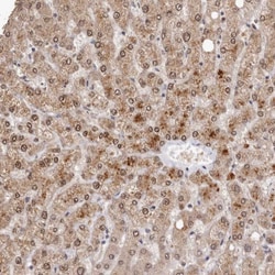 Invitrogen SULT1E1 Polyclonal Antibody 100 &mu;L; Unconjugated:Antibodies,