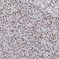 Invitrogen HP1BP3 Polyclonal Antibody 100 &mu;L; Unconjugated:Antibodies,