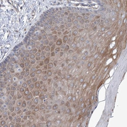Invitrogen eIF2d Polyclonal Antibody 100 &mu;L; Unconjugated:Antibodies,