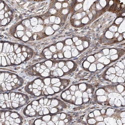 Invitrogen eIF2d Polyclonal Antibody 100 &mu;L; Unconjugated:Antibodies,