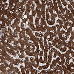 Invitrogen eIF2d Polyclonal Antibody 100 &mu;L; Unconjugated:Antibodies,