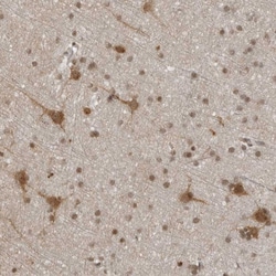 Invitrogen RASGEF1C Polyclonal Antibody 100 &mu;L; Unconjugated:Antibodies,