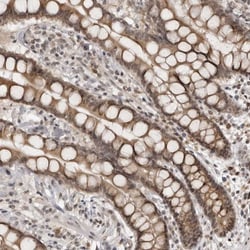 Invitrogen RASGEF1C Polyclonal Antibody 100 &mu;L; Unconjugated:Antibodies,