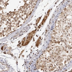 Invitrogen RASGEF1C Polyclonal Antibody 100 &mu;L; Unconjugated:Antibodies,